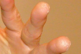 リッキーさんの指